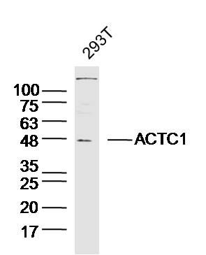 ACTC1 antibody