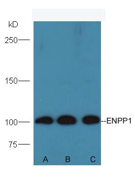 ENPP1核苷酸内焦磷酸酶/磷酸二酯酶1抗体