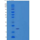 人血红蛋白亚单位θ-1/HBQ1重组蛋白N-6His