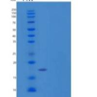 人血红蛋白亚单位θ-1/HBQ1重组蛋白N-6His