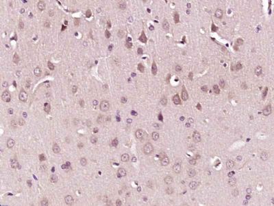 POMC阿黑皮素原抗体