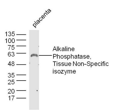 Alkaline Phosphatase, Tissue N