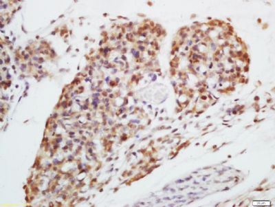 HSP40热休克蛋白家族40抗体