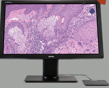 ASI与巴可伟视在数字病理学显示器达成全球合作