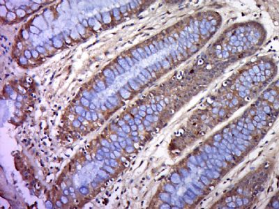 BTN2A1嗜乳脂蛋白2亚型A1抗体