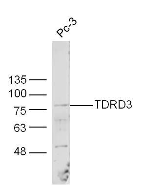 TDRD3 Tudor结构域蛋白TDRD3抗体