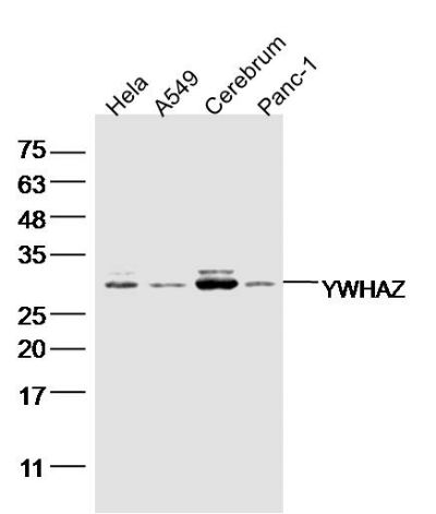 YWHAZ小鼠抗14-3-3蛋白zeta/delta单克隆抗