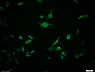 SLC10A1 antibody