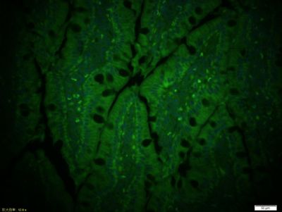 CD13氨肽酶N抗体