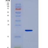 人CD16b / FCGR3B蛋白，生物素化重组蛋白
