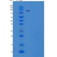 人钙粘蛋白-11/o B-钙粘蛋白/CDH11重组蛋白C-Fc-6His