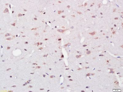 UBE2Q1 antibody
