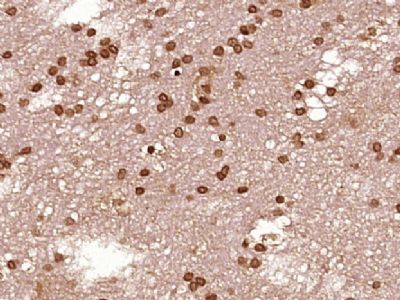 STAT1 p84+p91信号转导与转录激活因子1抗体