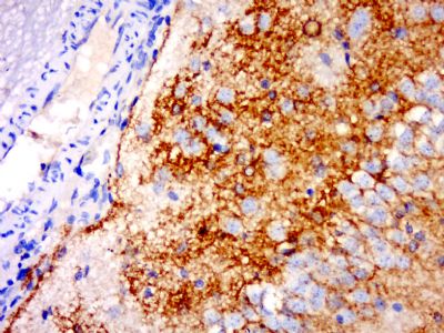 IGSF21 antibody