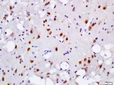 Phospho-Histone H2A.X (Tyr143)