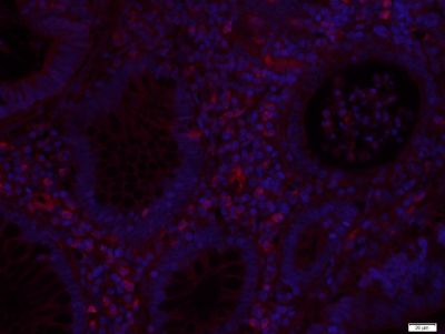 EpCAM上皮细胞粘附分子抗体