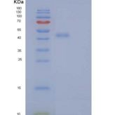 人内质网驻留蛋白44/ERp44/TXNDC4重组蛋白C-6His