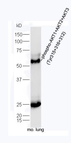 phospho-AKT1+AKT2+AKT3 (Tyr315