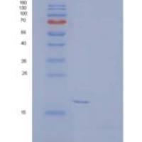 小鼠髓样细胞2b/TREM-2b上表达的触发受体重组蛋白C-6His