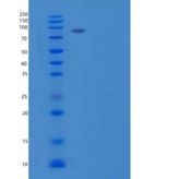 小鼠α-1-抗胰蛋白酶1-3/丝氨酸蛋白酶抑制剂A1b重组蛋白C-6His