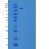 小鼠α-1-抗胰蛋白酶1-3/丝氨酸蛋白酶抑制剂A1b重组蛋白C-6His