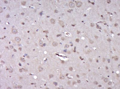 phospho-ZIP Kinase (Thr265)磷酸化