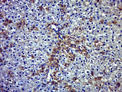 PARP14多腺苷二磷酸多聚酶PARP14抗体