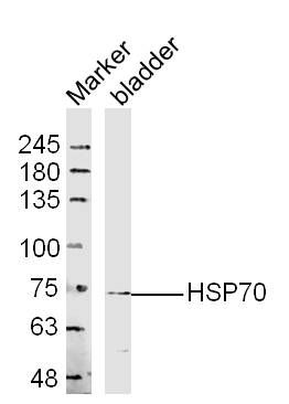 HSP70热休克蛋白70抗体