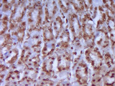 phospho-CK18(Ser52)磷酸化细胞角蛋白18抗