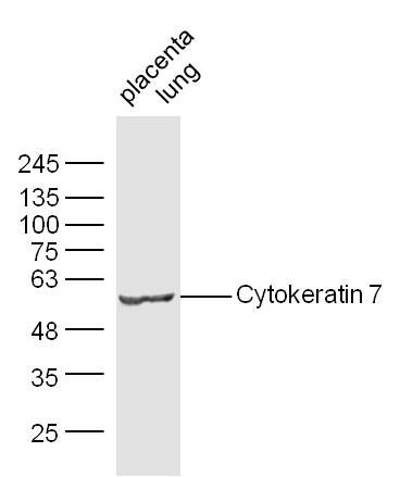 Cytokeratin 7 antibody