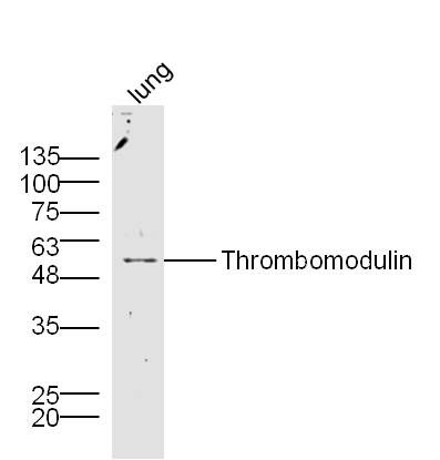 Thrombomodulin antibody