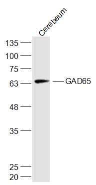 GAD65谷氨酸脱羧酶-65抗体