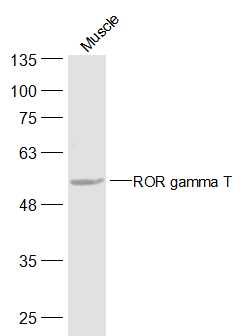 ROR gamma T antibody