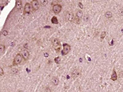 phospho-Alpha synuclein (Tyr13