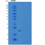 人G-CSF / CSF3重组蛋白isoform b