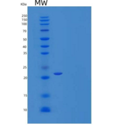 人α-1-酸性糖蛋白2/AGP2/ORM2重组蛋白C-6Hi