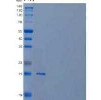 人视黄醇结合蛋白5重组蛋白