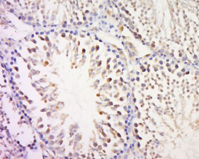 MAGEB3 antibody