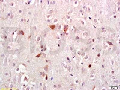 LRRK2富亮氨酸重复激酶2抗体
