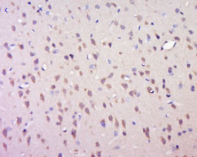 phospho-FOXO4 (Ser262)磷酸化叉头蛋白4