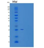 人PRL- 2/PTP4A2重组蛋白C-6His