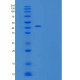 小鼠Chordin样蛋白2/CHL2/CHRDL2重组蛋白C-6His