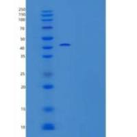 小鼠Chordin样蛋白2/CHL2/CHRDL2重组蛋白C-6His