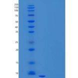 人白细胞介素-8重组蛋白