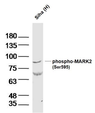 phospho-MARK2(Thr596)磷酸化丝氨酸/苏氨