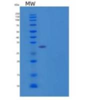人Cerberus 1/DAND4重组蛋白C-6His
