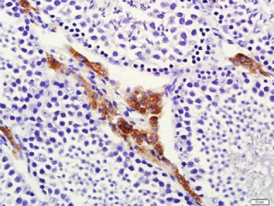 CYP17细胞色素P450 17抗体