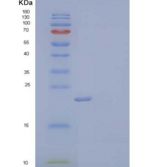 人胞浆磷蛋白1(STMN1)重组蛋白C-6His