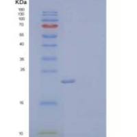 人胞浆磷蛋白1(STMN1)重组蛋白C-6His