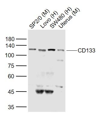 CD133造血干细胞抗原CD133抗体